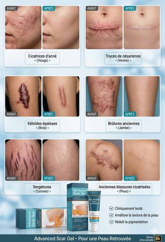 Gel anti-cicatrices/Scar gel