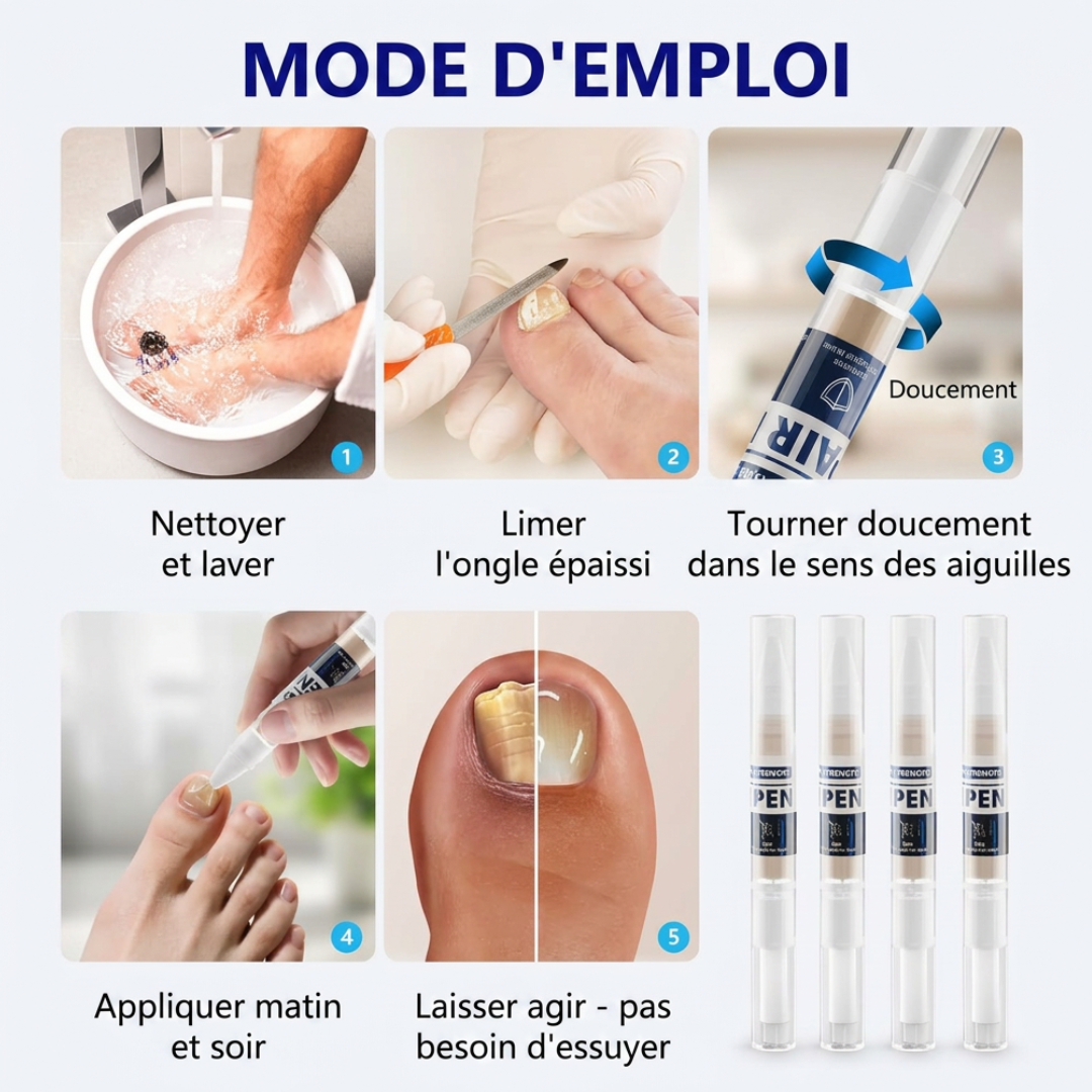 Stylo antifongique. Formule avancée contre le pied d'athlète et les mycoses des ongles